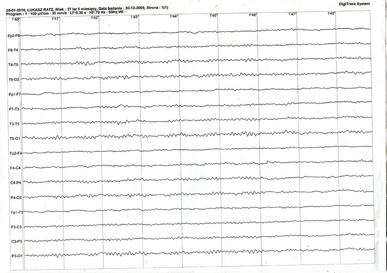 EEG 2