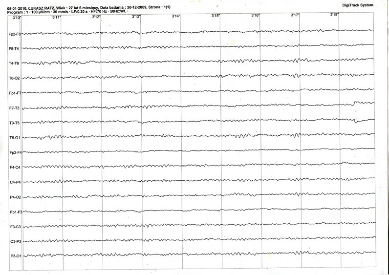 EEG 3