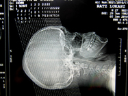 MRI 1