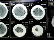 MRI 2