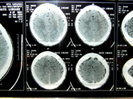 MRI 3