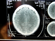 MRI 4
