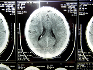 MRI 6
