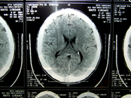 MRI 7
