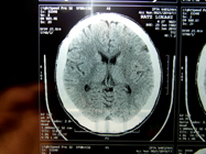 MRI 8