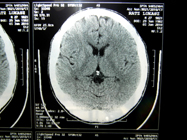 MRI 9