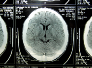 MRI 10