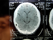 MRI 12