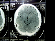 MRI 13