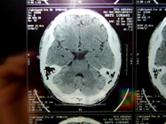MRI 16