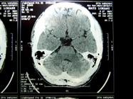MRI 17