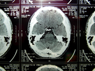 MRI 19