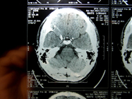 MRI 20