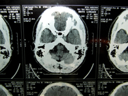 MRI 22