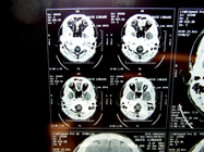 MRI 24
